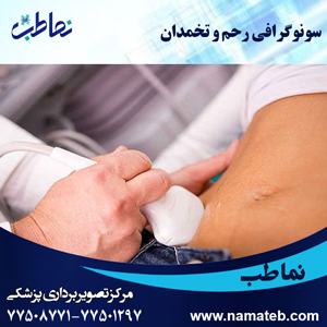 سونوگرافی رحم و تخمدان