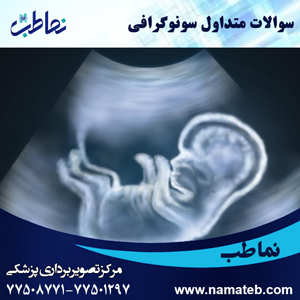 سوالات متداول سونوگرافی