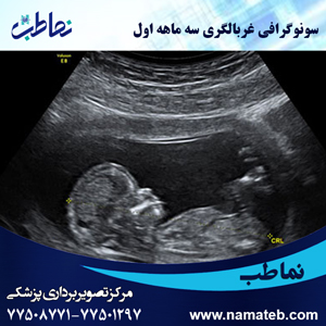 سونوگرافی-غربالگری-سه-ماهه-اول