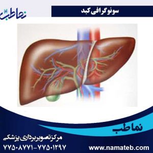 سونوگرافی-کبد