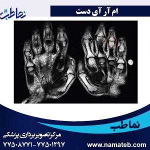 ام-آر-آی-دست