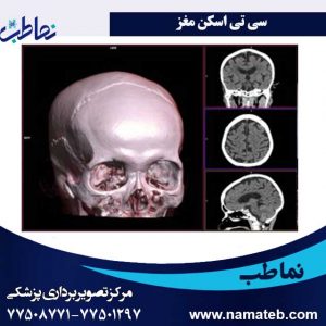 سی-تی-اسکن-مغز