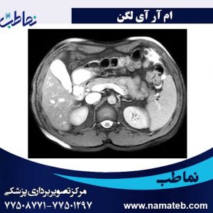 ام-آر-آی-لگن